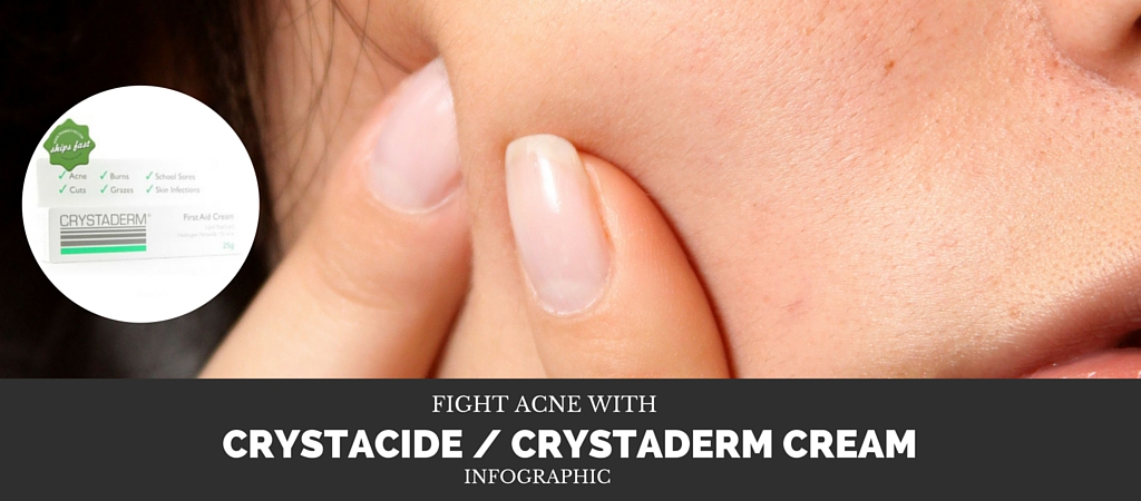 Fight Acne With Crystacide Cream (Now called Crystaderm)